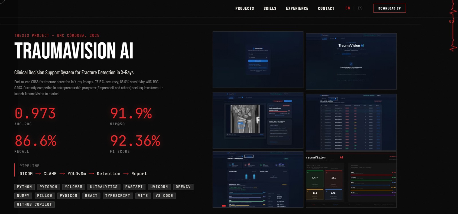 Proyecto TraumaVision AI — detección de fracturas en rayos X